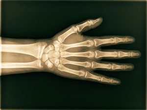 Radiografia de mão e punho em tons dourados sobre fundo verde escuro